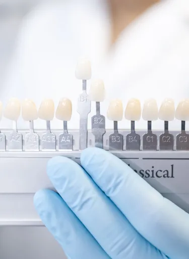 Dental Veneers at Elwell Family Dentistry in Canton, Georgia